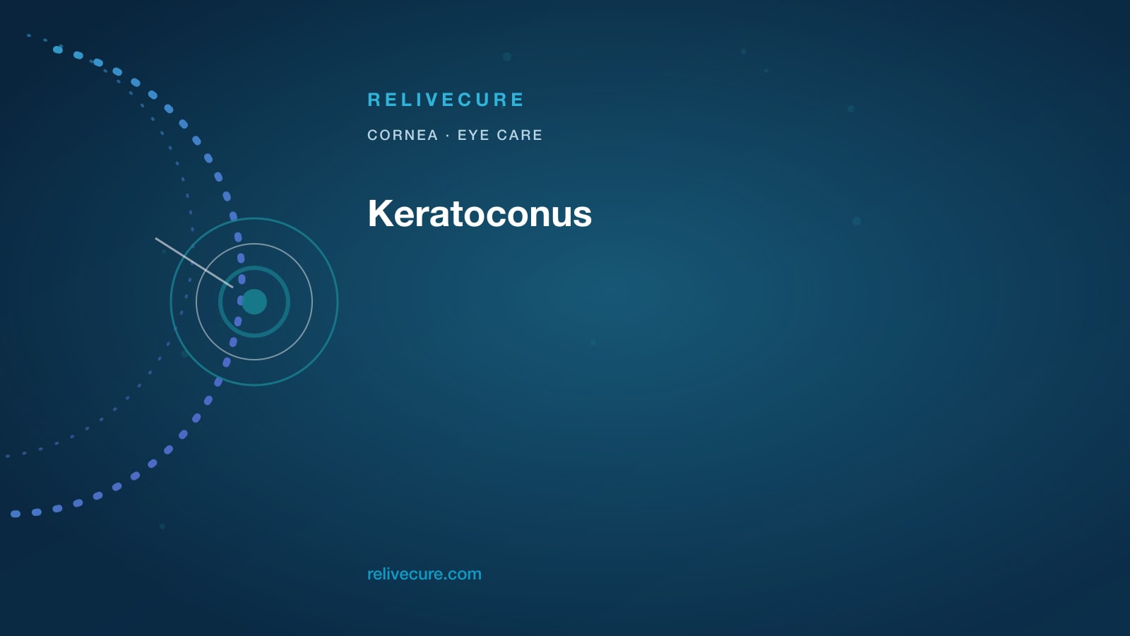 ReliveCure navy-and-cyan editorial still: Keratoconus: When “My Number Increased” Needs a Cornea Map