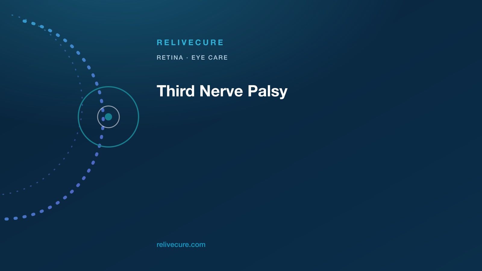 ReliveCure navy-and-cyan editorial still: Third Nerve Palsy: Double Vision, Droop, When the Pupil Makes It Urgent